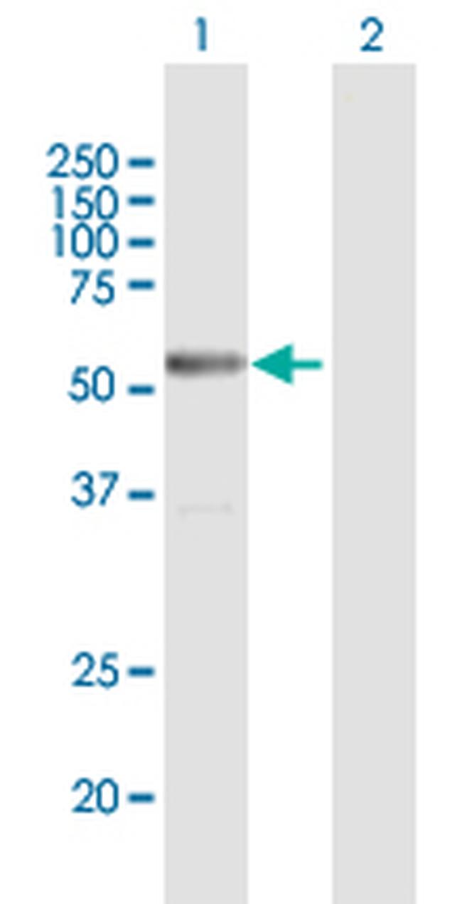 METTL4 Antibody in Western Blot (WB)