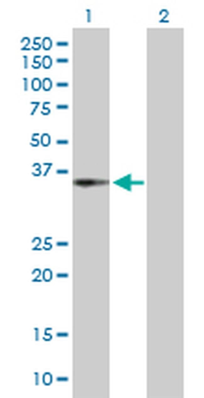 CENPH Antibody in Western Blot (WB)