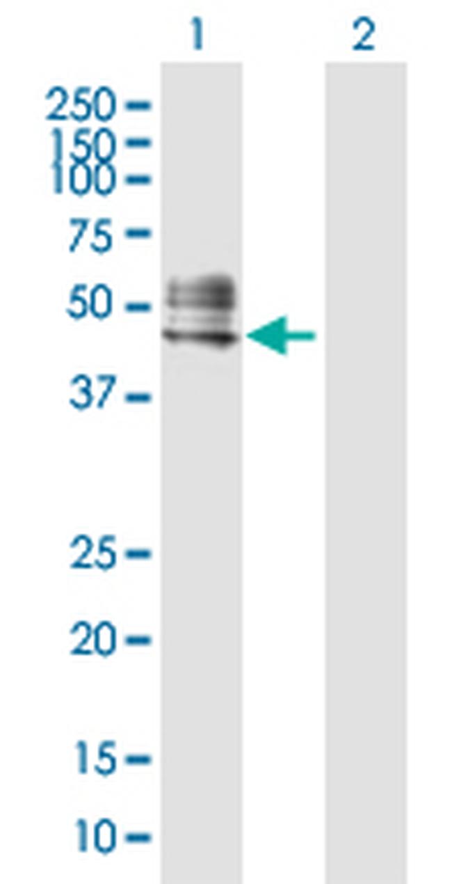 RTN4R Antibody in Western Blot (WB)