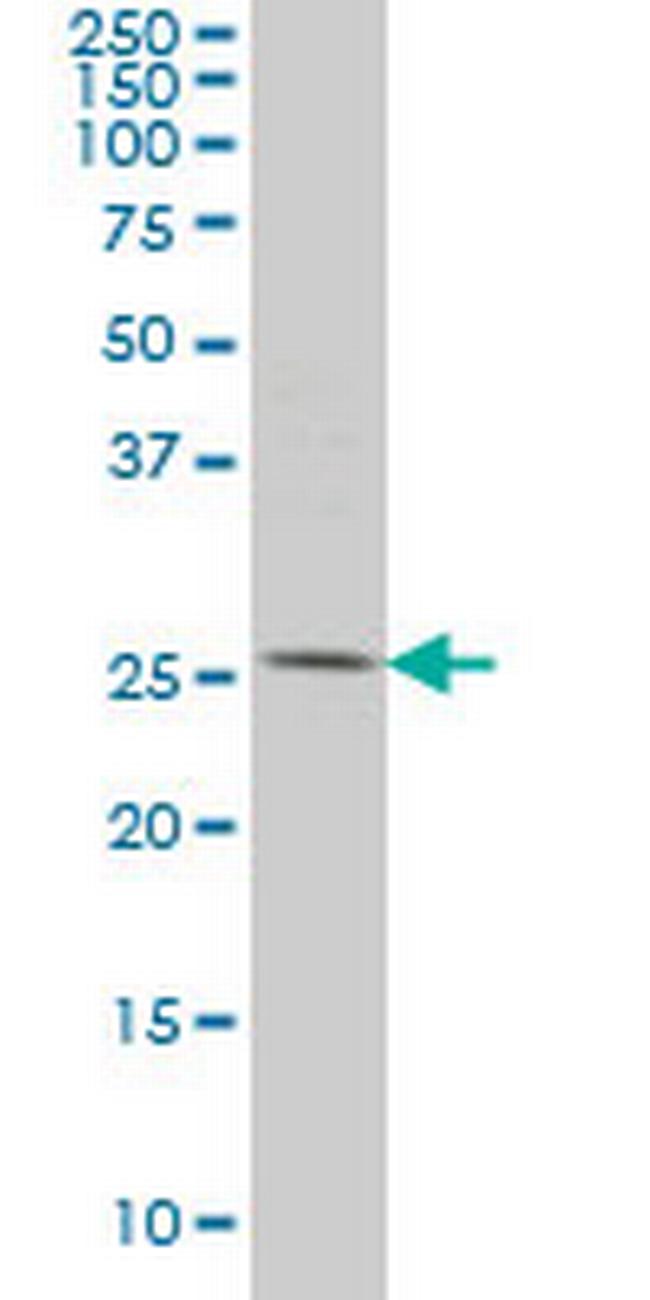 PYCRL Antibody in Western Blot (WB)