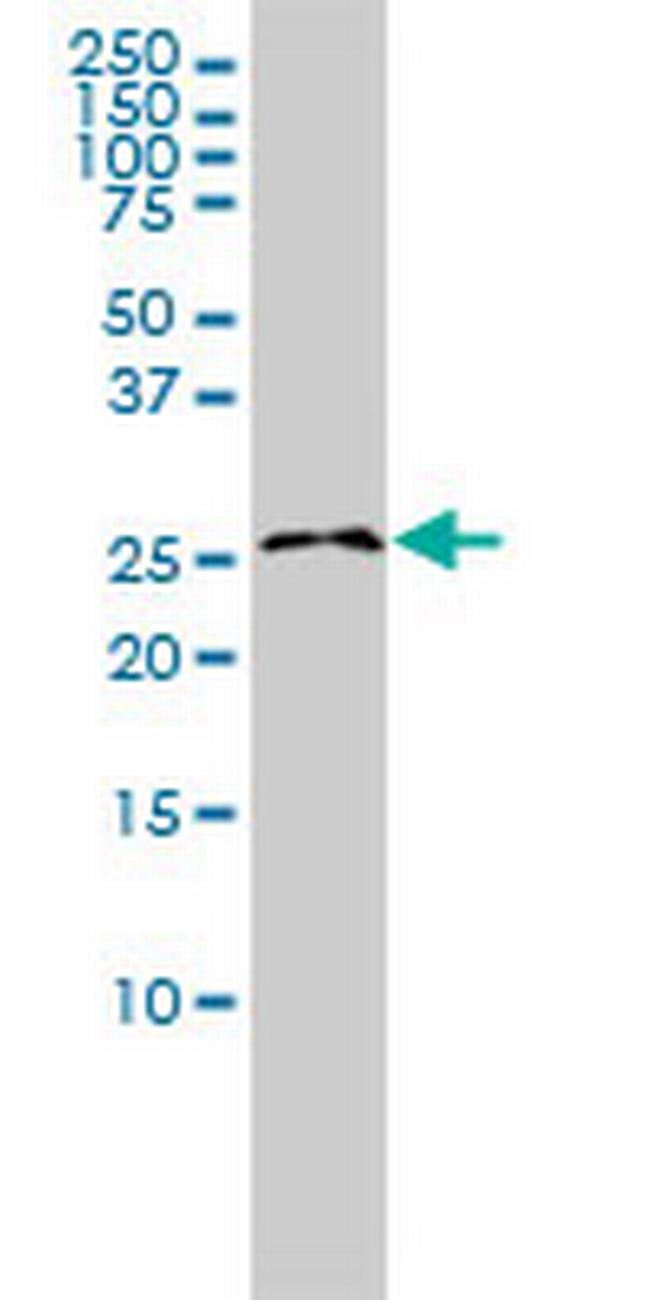 RASL11B Antibody in Western Blot (WB)