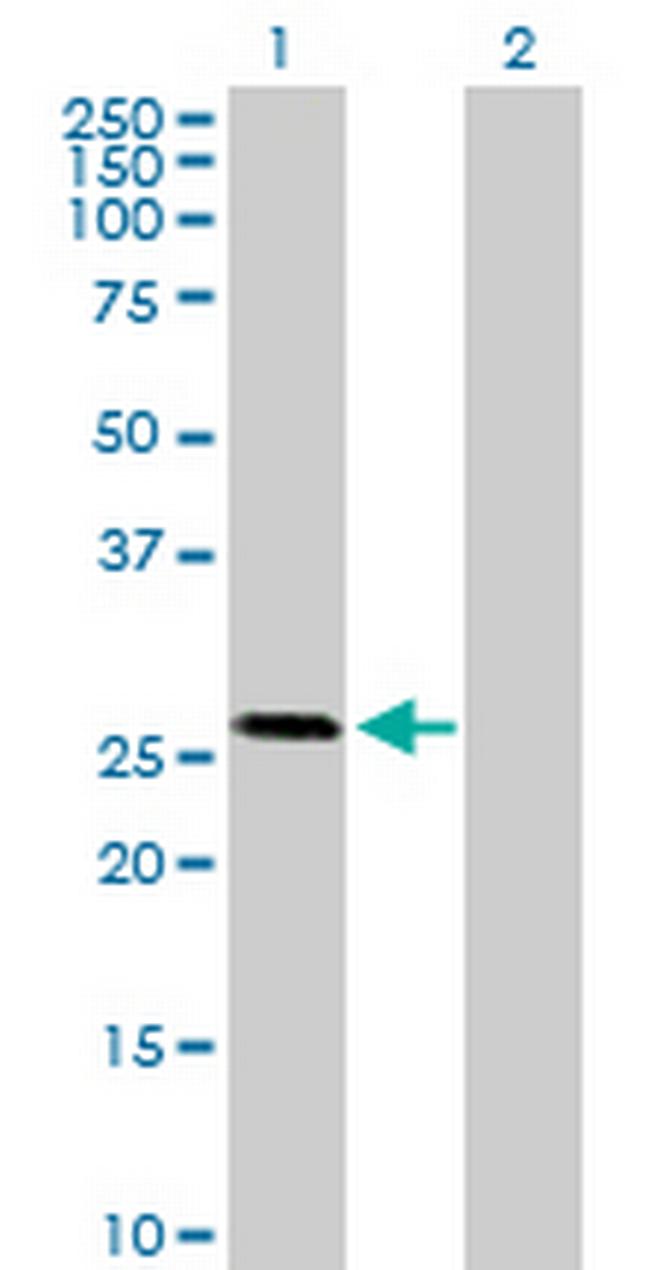 OTUB2 Antibody in Western Blot (WB)