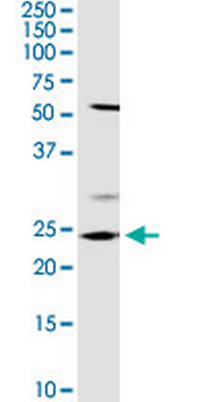 OTUB2 Antibody in Western Blot (WB)