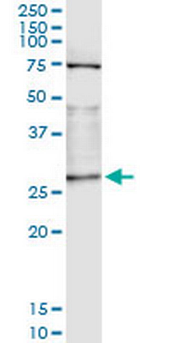 OTUB2 Antibody in Immunoprecipitation (IP)