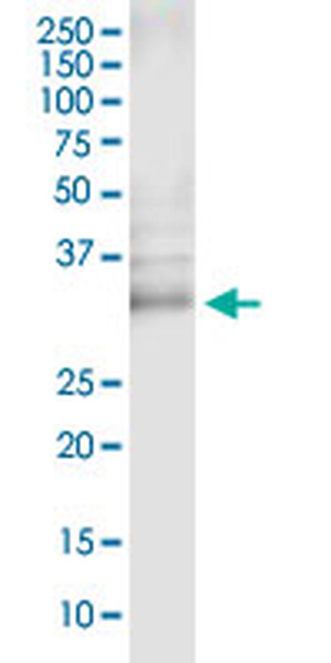 CUEDC2 Antibody in Western Blot (WB)