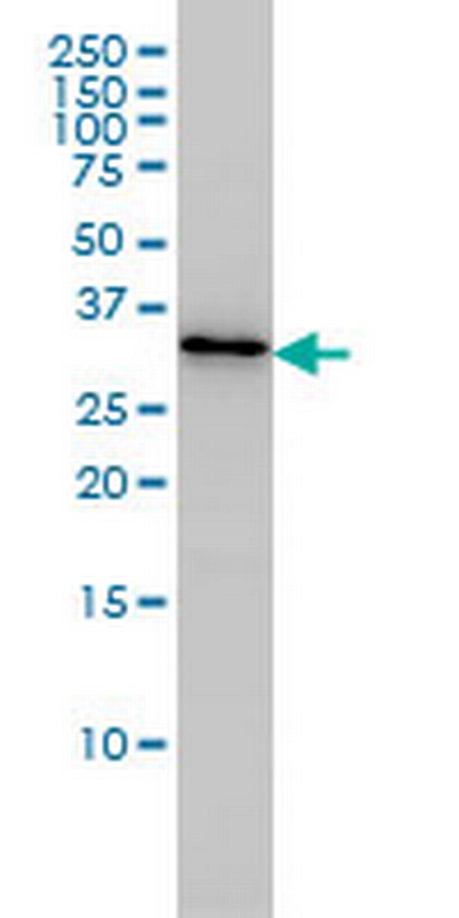 PDCL3 Antibody in Western Blot (WB)