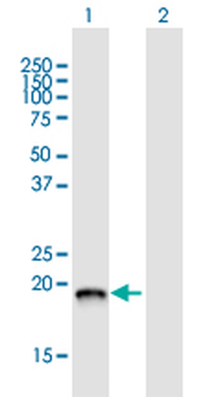 XTP3TPA Antibody in Western Blot (WB)