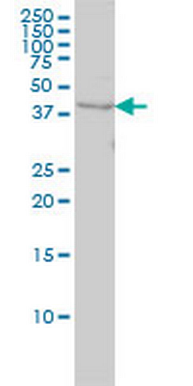 WDR77 Antibody in Western Blot (WB)