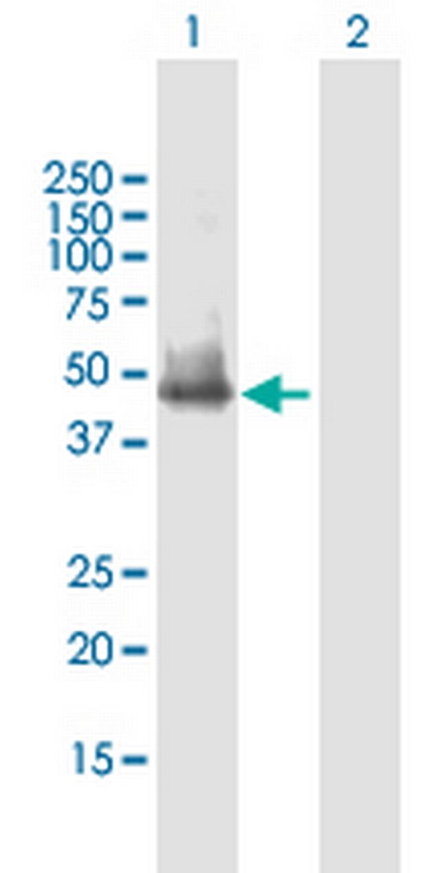 SLC25A23 Antibody in Western Blot (WB)