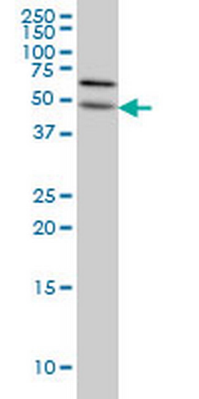 ALG12 Antibody in Western Blot (WB)