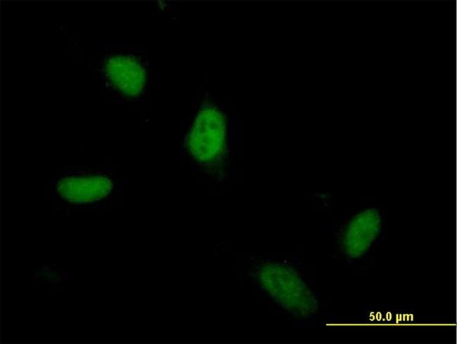 ZSCAN5A Antibody in Immunocytochemistry (ICC/IF)