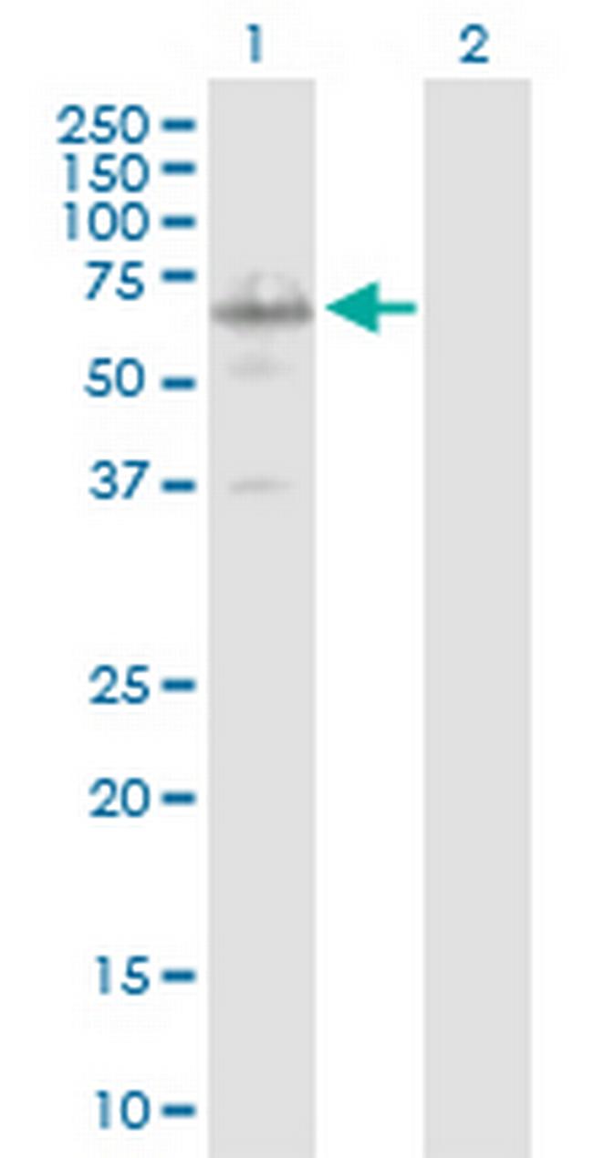 IRX3 Antibody in Western Blot (WB)