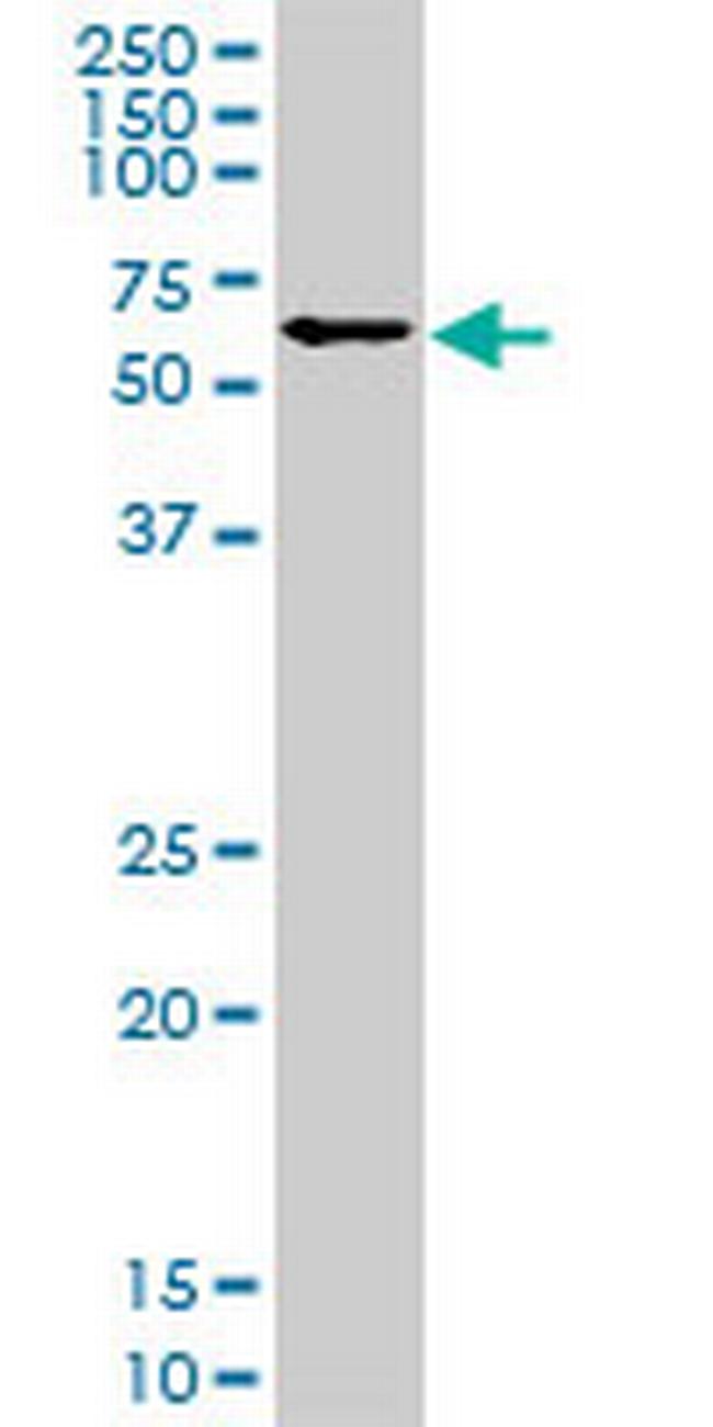 IRX3 Antibody in Western Blot (WB)