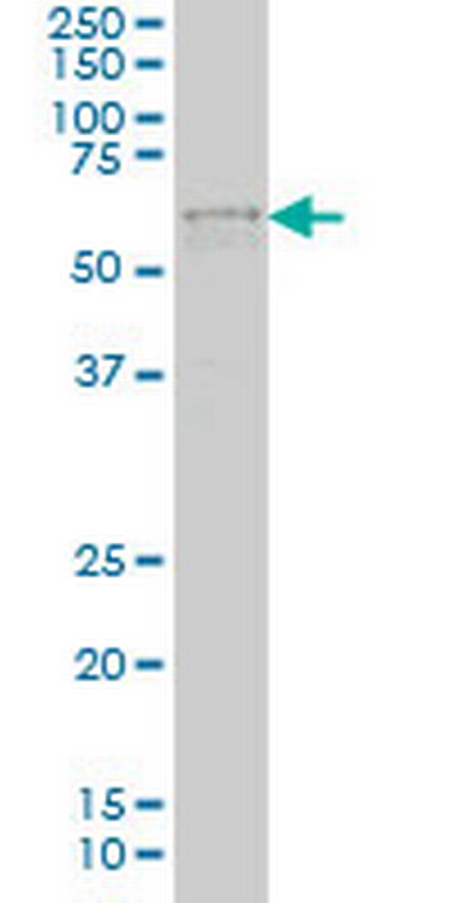 IRX3 Antibody in Western Blot (WB)