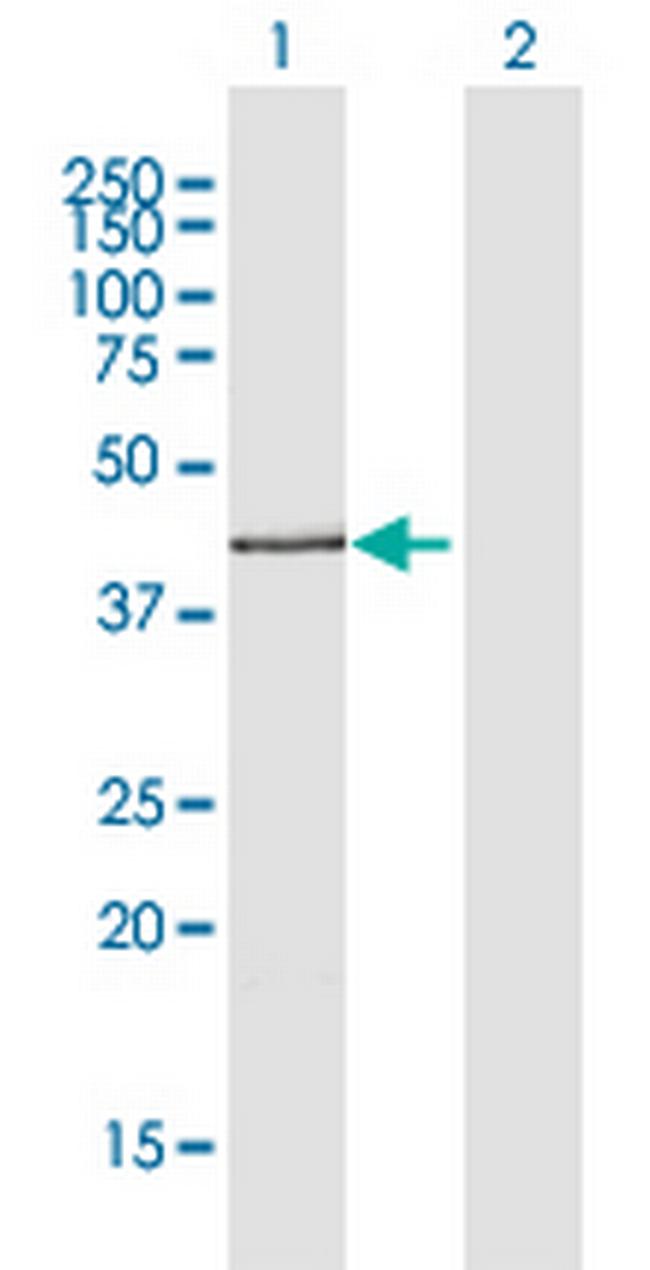 ADIPOR2 Antibody in Western Blot (WB)