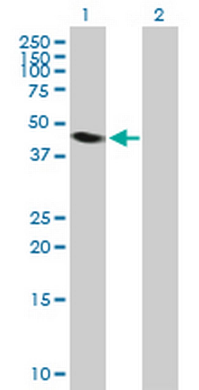 NEIL1 Antibody in Western Blot (WB)