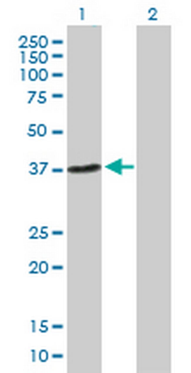 NHEJ1 Antibody in Western Blot (WB)