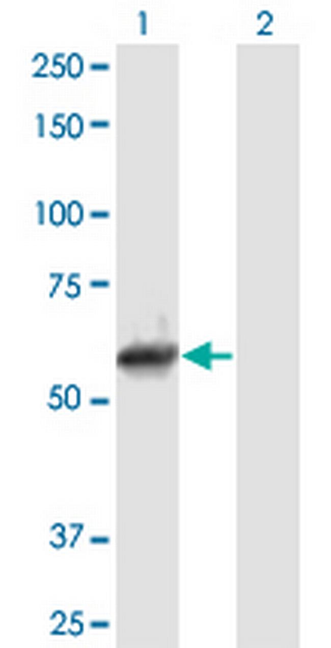 NEK11 Antibody in Western Blot (WB)