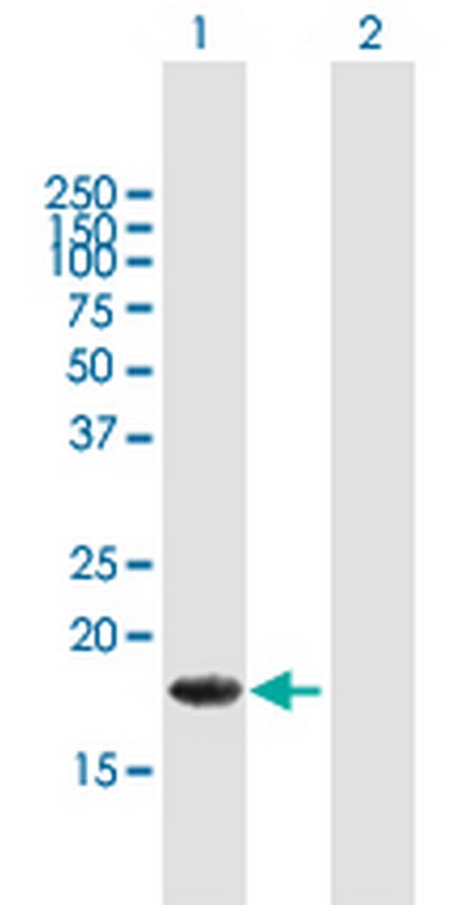 ALG13 Antibody in Western Blot (WB)