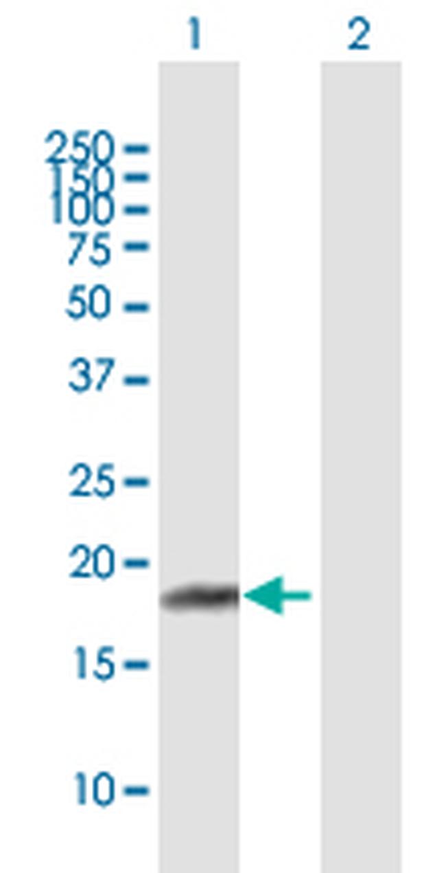 RPP21 Antibody in Western Blot (WB)