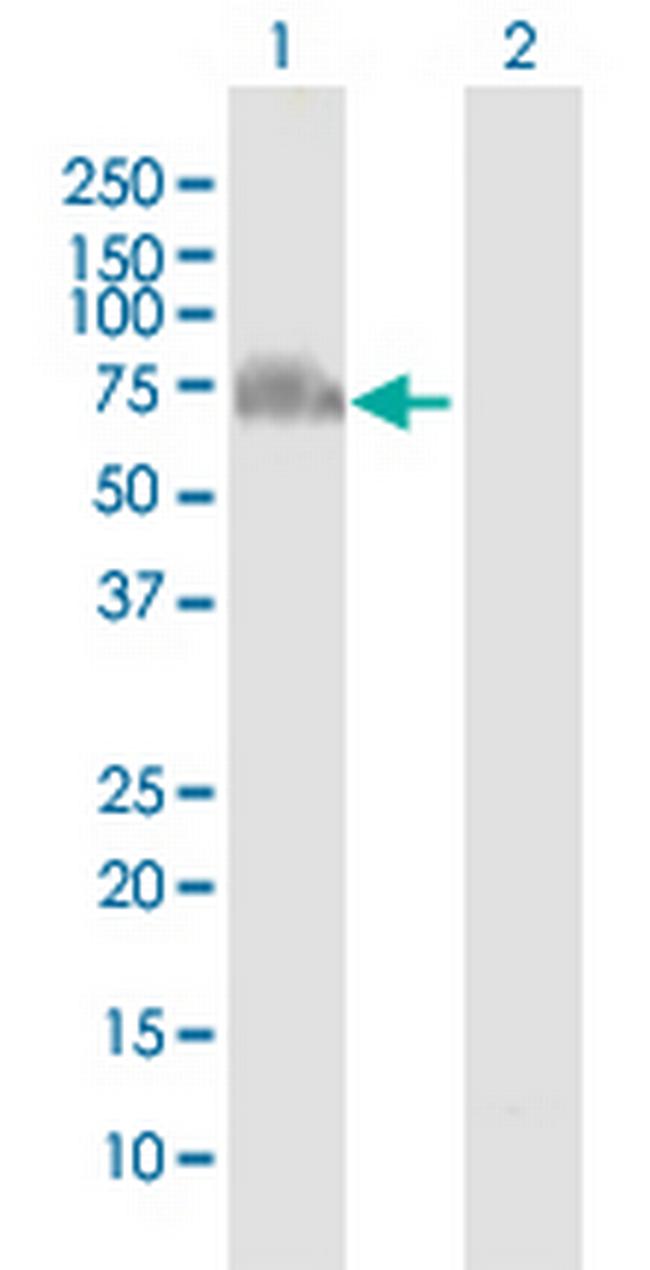 GRHL2 Antibody in Western Blot (WB)