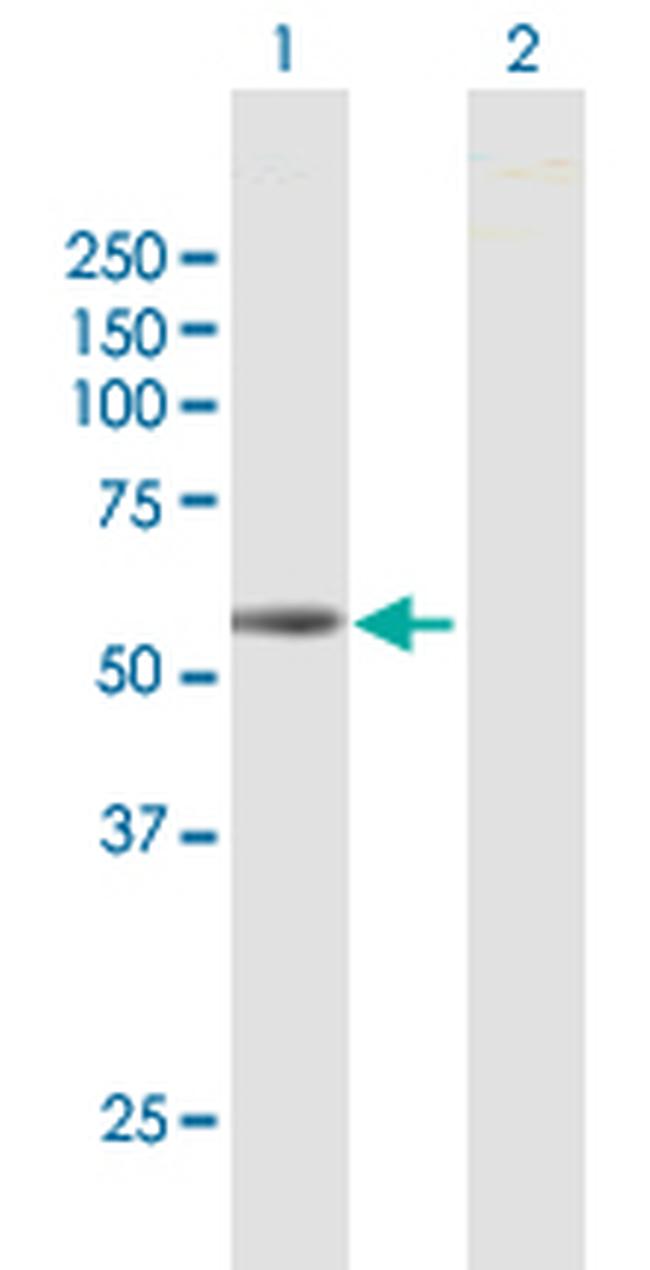 SEMA6D Antibody in Western Blot (WB)