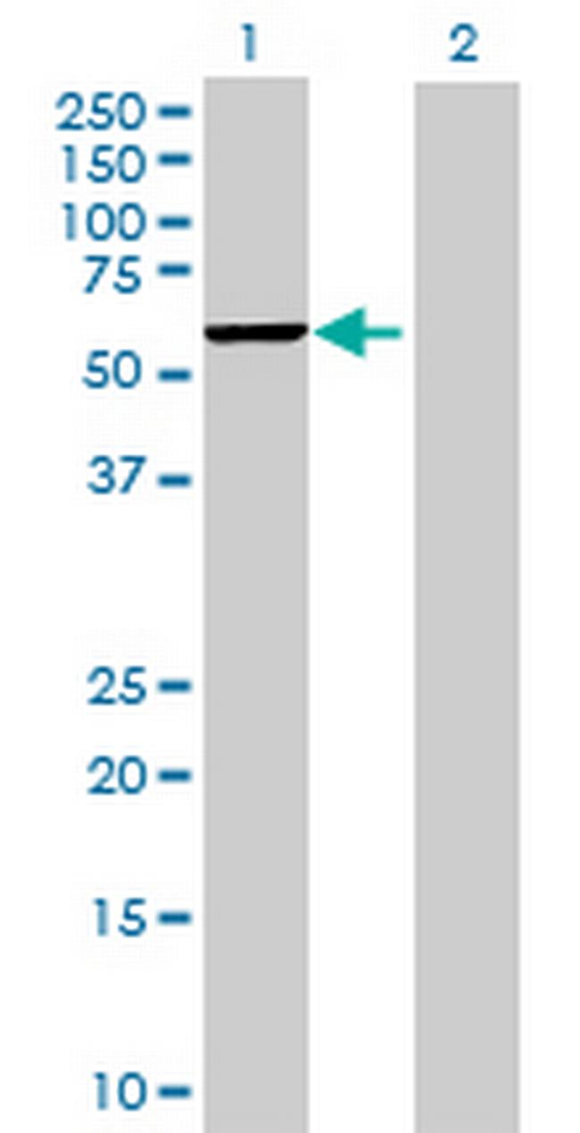 ZNF556 Antibody in Western Blot (WB)