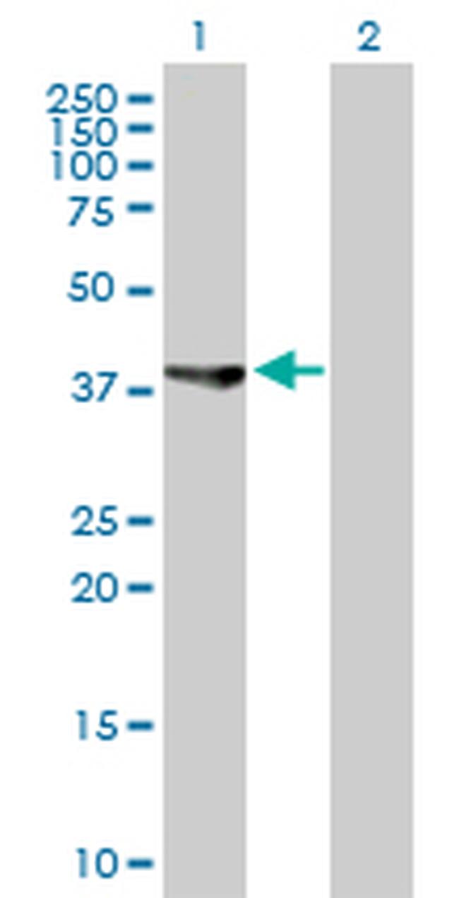 ASRGL1 Antibody in Western Blot (WB)