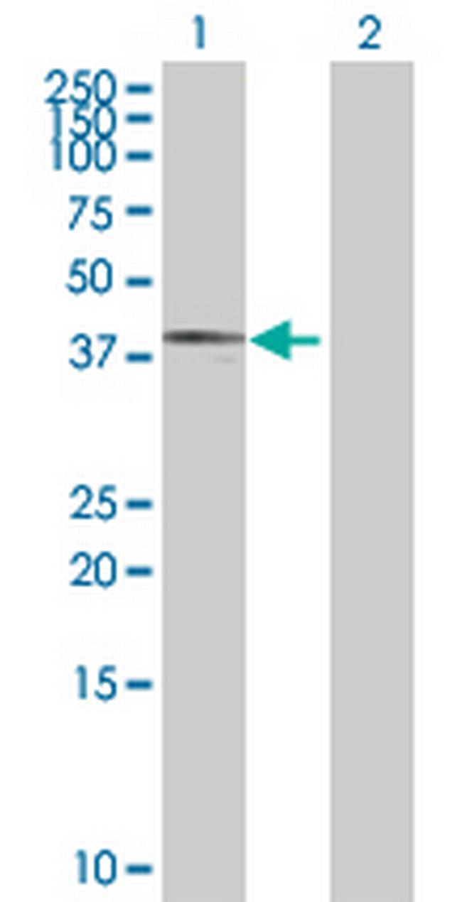 MTERFD3 Antibody in Western Blot (WB)