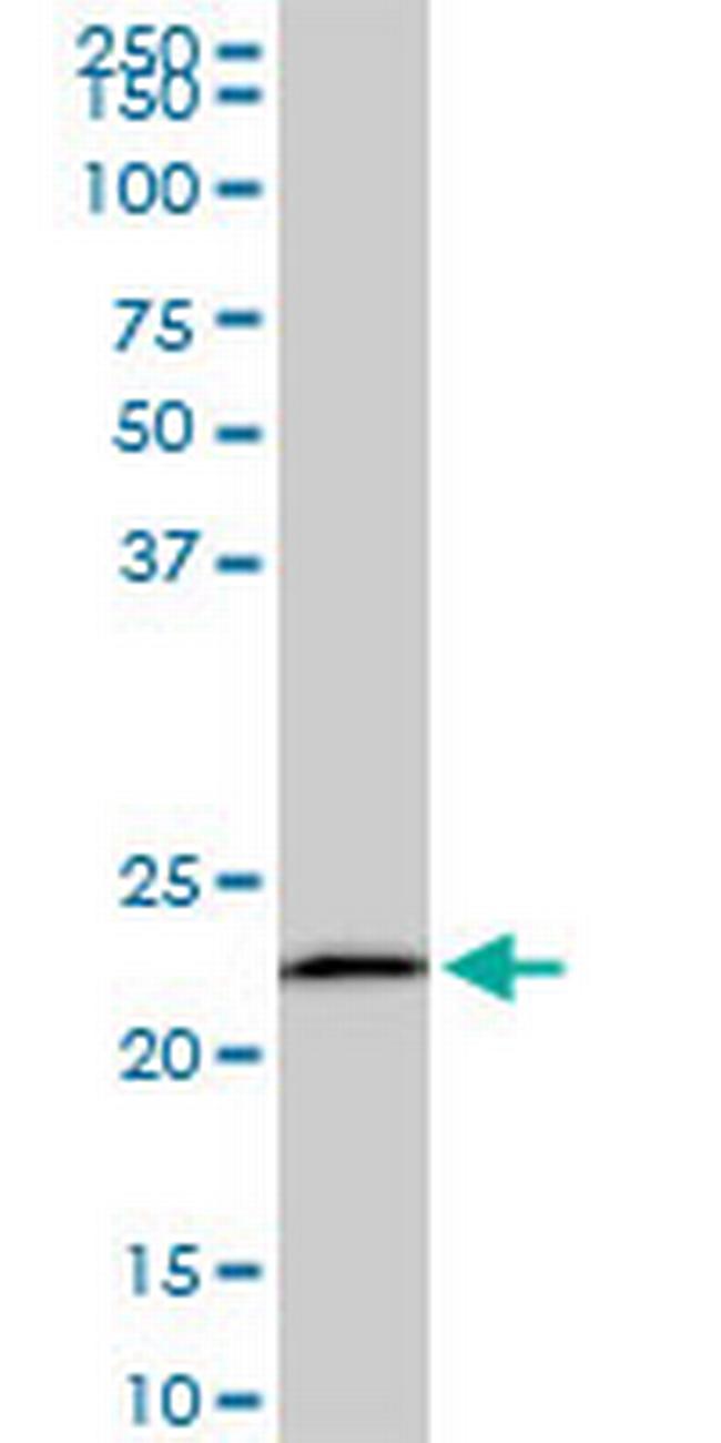 EFHD1 Antibody in Western Blot (WB)