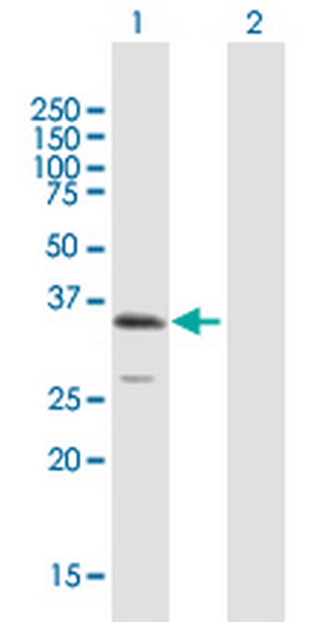 ULBP1 Antibody in Western Blot (WB)