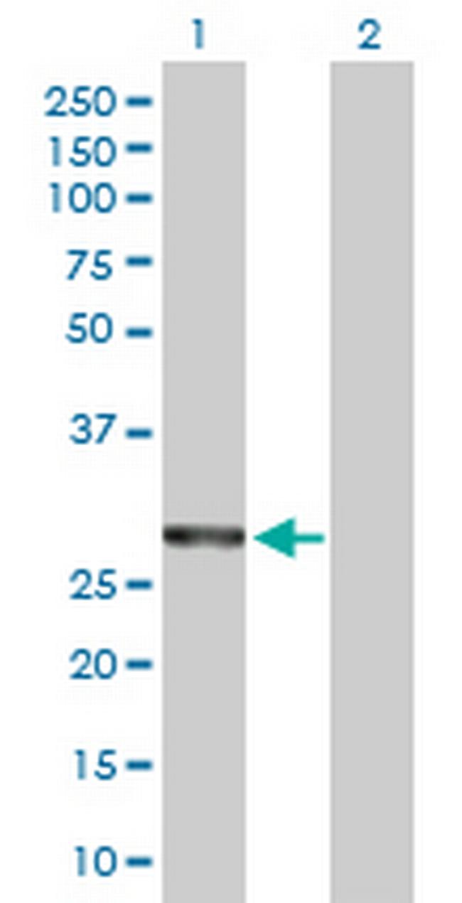 COASY Antibody in Western Blot (WB)