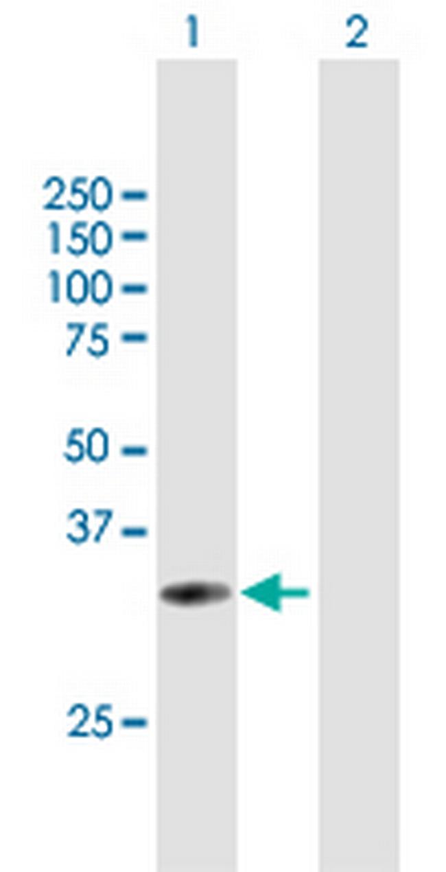 UPK3B Antibody in Western Blot (WB)