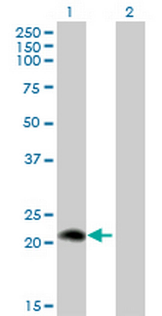 PLA2G12A Antibody in Western Blot (WB)