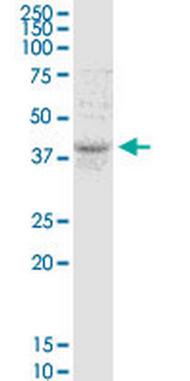 TMEM49 Antibody in Western Blot (WB)