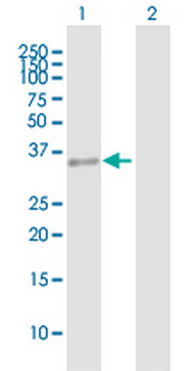 HLRC1 Antibody in Western Blot (WB)