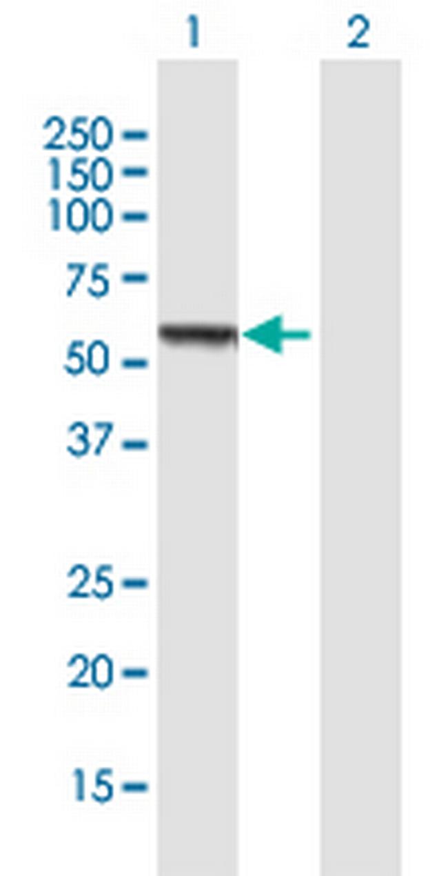 CCM2 Antibody in Western Blot (WB)