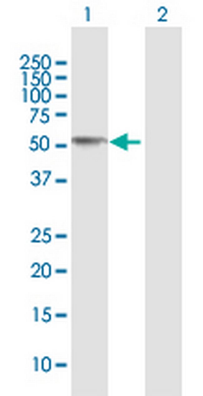 CCM2 Antibody in Western Blot (WB)