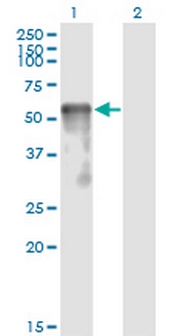 SESN2 Antibody in Western Blot (WB)