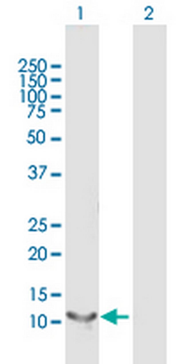 RBP5 Antibody in Western Blot (WB)