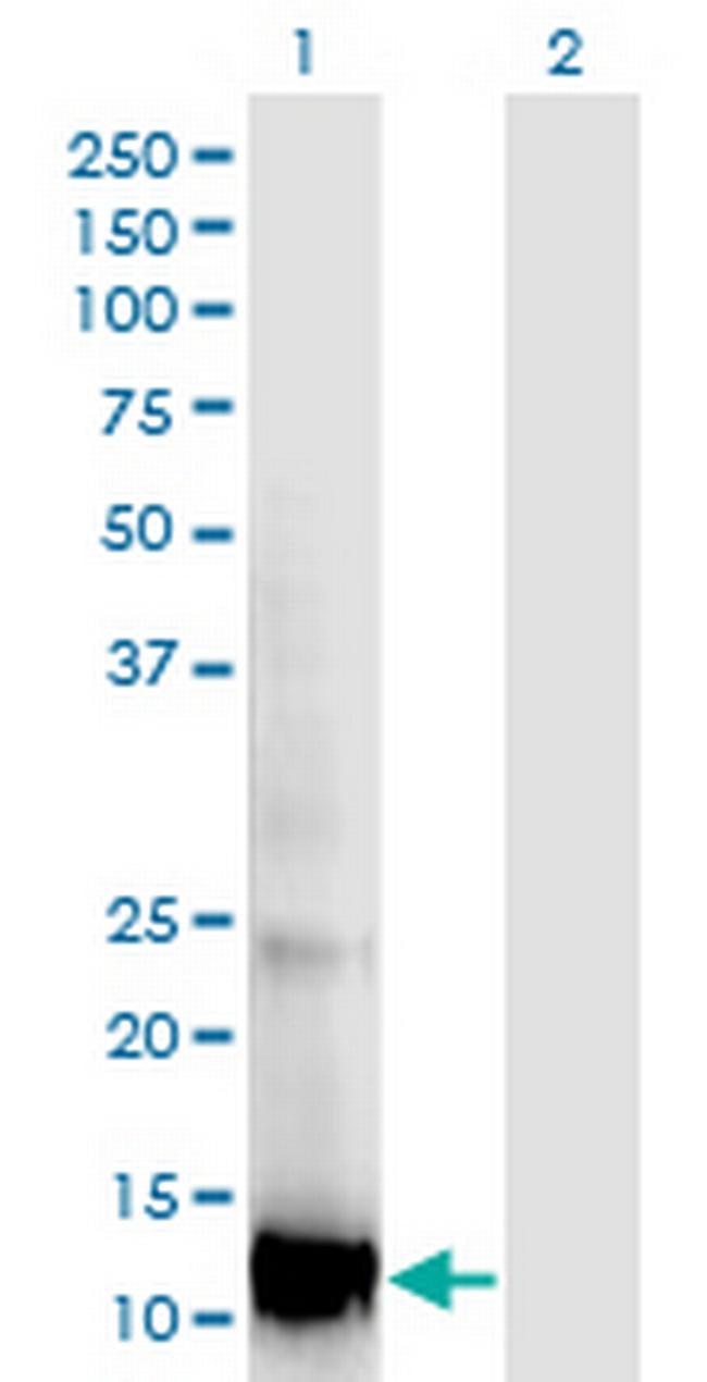 RBP5 Antibody in Western Blot (WB)