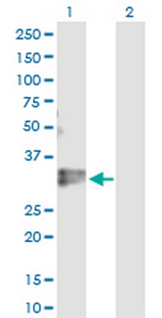 KLF16 Antibody in Western Blot (WB)