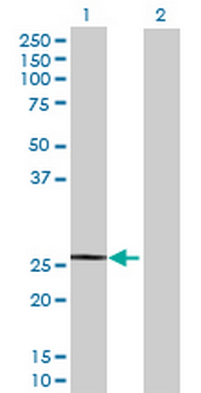 KIRREL2 Antibody in Western Blot (WB)