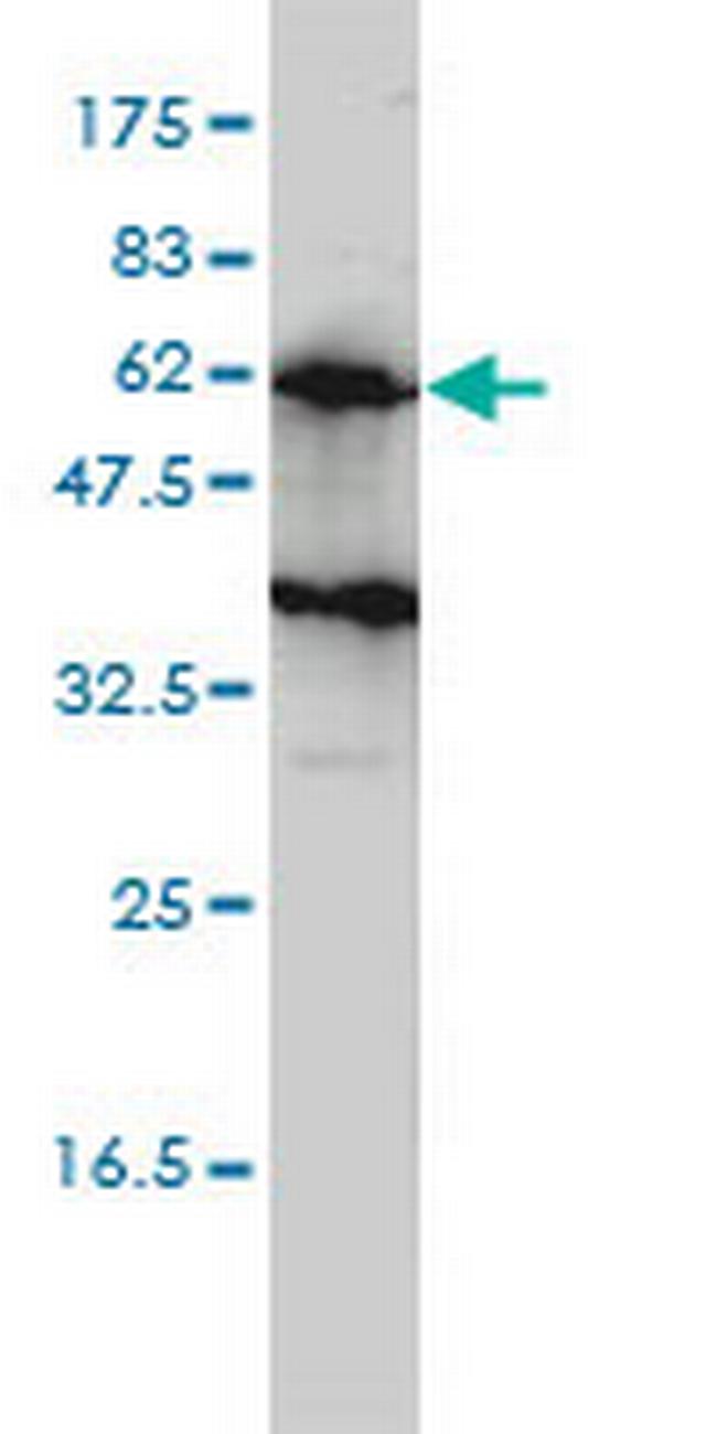 KIRREL2 Antibody in Western Blot (WB)