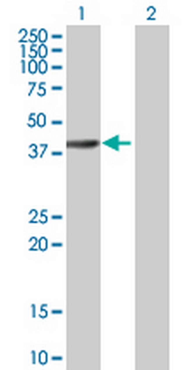 RBED1 Antibody in Western Blot (WB)