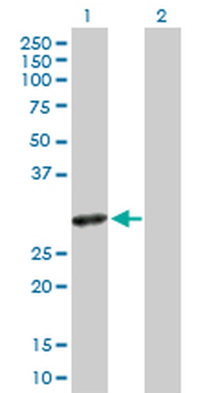 SLA2 Antibody in Western Blot (WB)