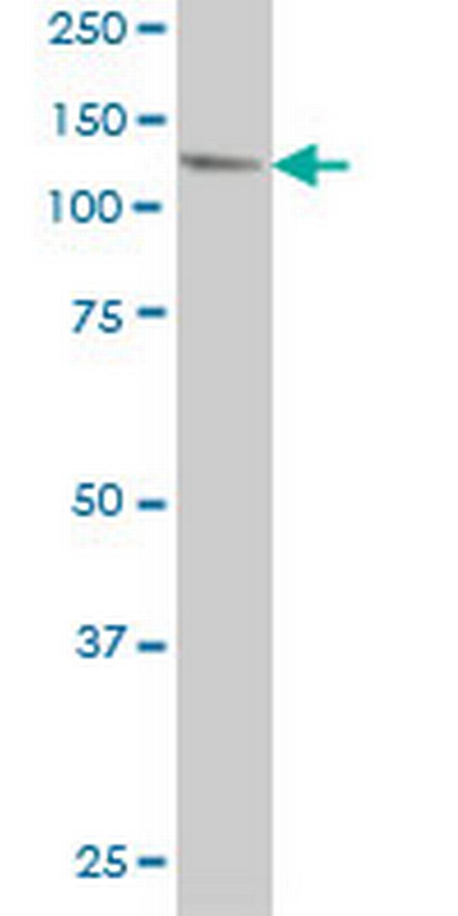 USP48 Antibody in Western Blot (WB)