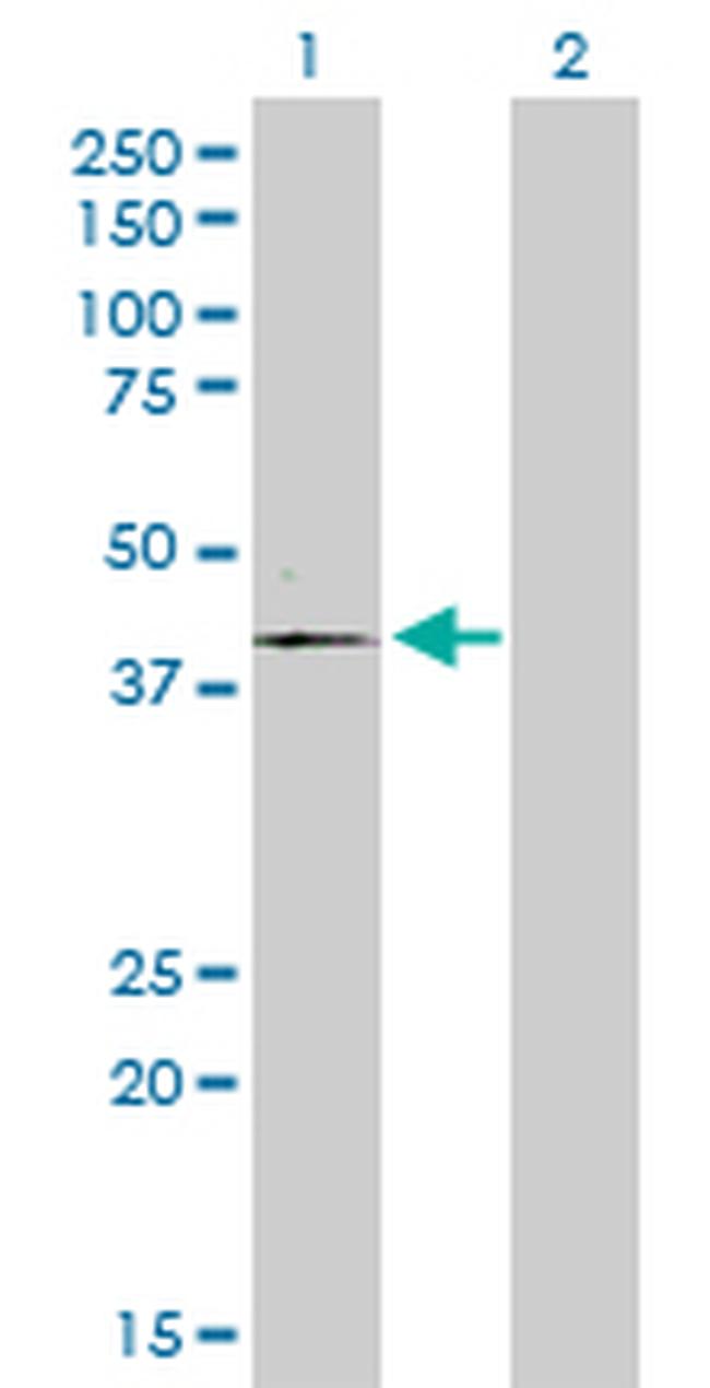 FLJ23356 Antibody in Western Blot (WB)