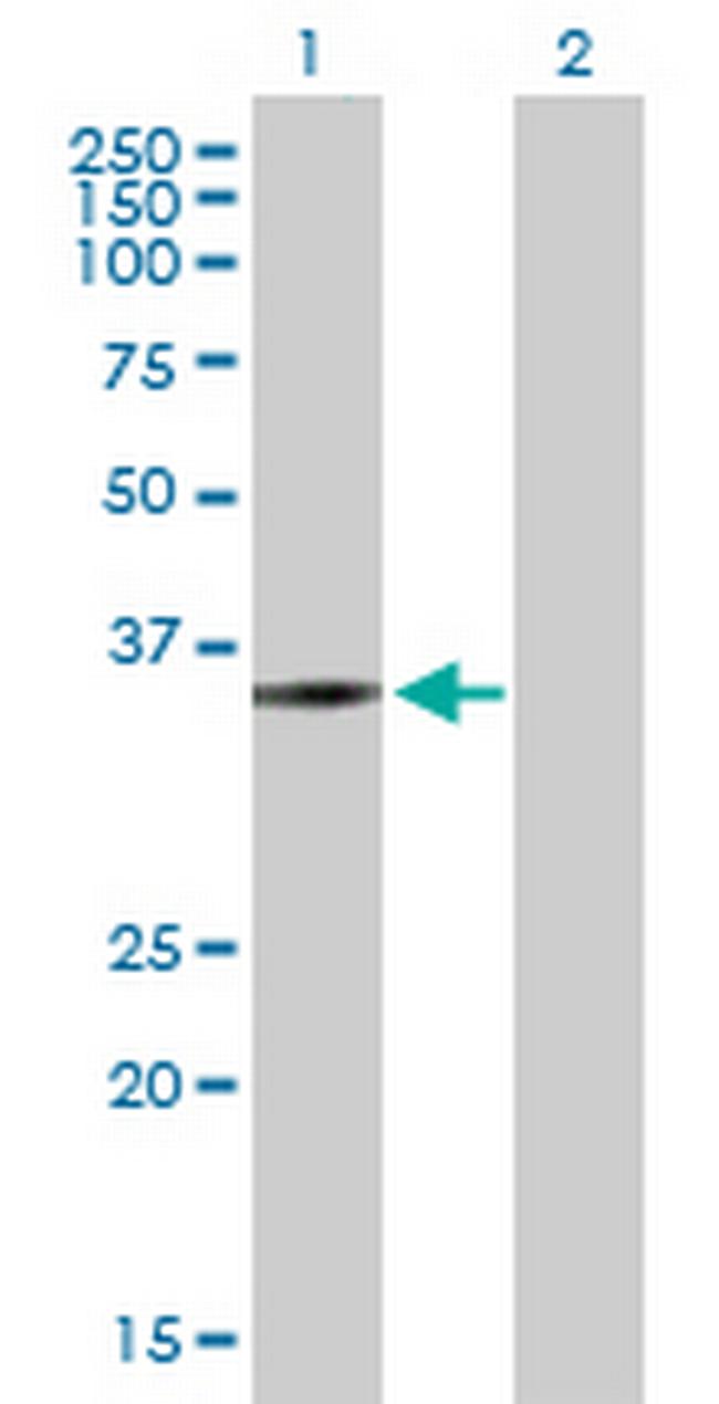 ZMYND12 Antibody in Western Blot (WB)