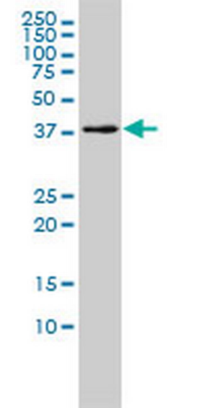 MGC3207 Antibody in Western Blot (WB)